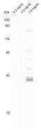 Histone Deacetylase 9 antibody, NB100-56382, Novus Biologicals, Western Blot image 
