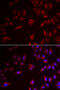 Preferentially Expressed Antigen In Melanoma antibody, abx004948, Abbexa, Western Blot image 