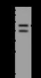 Lysine Acetyltransferase 8 antibody, 207529-T32, Sino Biological, Western Blot image 