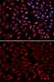 Proteasome 26S Subunit, ATPase 2 antibody, GTX54583, GeneTex, Immunofluorescence image 