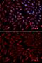 Proteasome 26S subunit ATPase 2 antibody, GTX54583, GeneTex, Immunofluorescence image 