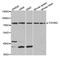 Transforming Growth Factor Beta Receptor 2 antibody, TA332398, Origene, Western Blot image 