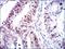 Cyclin Dependent Kinase 2 antibody, NBP2-37507, Novus Biologicals, Immunohistochemistry paraffin image 