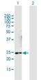 Nicotinamide Nucleotide Adenylyltransferase 3 antibody, H00349565-B01P, Novus Biologicals, Western Blot image 