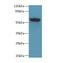 Pleckstrin Homology Domain Containing A8 antibody, LS-C379176, Lifespan Biosciences, Western Blot image 