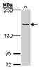DNA Topoisomerase II Alpha antibody, GTX100689, GeneTex, Western Blot image 