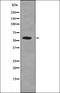 Leptin Receptor antibody, orb335887, Biorbyt, Western Blot image 