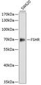 Follicle Stimulating Hormone Receptor antibody, 18-977, ProSci, Western Blot image 