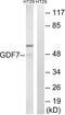 Growth Differentiation Factor 7 antibody, PA5-39195, Invitrogen Antibodies, Western Blot image 