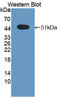 Sprouty Related EVH1 Domain Containing 2 antibody, LS-C705368, Lifespan Biosciences, Western Blot image 