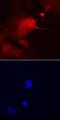 Amyloid Beta Precursor Protein Binding Family B Member 1 Interacting Protein antibody, PA5-47911, Invitrogen Antibodies, Immunocytochemistry image 