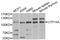 U3 small nucleolar RNA-associated protein 14 homolog A antibody, abx005874, Abbexa, Western Blot image 