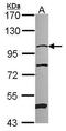 N-alpha-acetyltransferase 15, NatA auxiliary subunit antibody, GTX115560, GeneTex, Western Blot image 