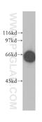 Membrane Palmitoylated Protein 7 antibody, 12983-1-AP, Proteintech Group, Western Blot image 