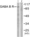 Gamma-Aminobutyric Acid Type B Receptor Subunit 1 antibody, abx013083, Abbexa, Western Blot image 