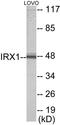 Iroquois Homeobox 1 antibody, EKC1762, Boster Biological Technology, Western Blot image 