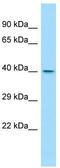 WD Repeat Domain 45B antibody, TA345271, Origene, Western Blot image 