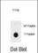 Insulin Receptor antibody, abx032029, Abbexa, Western Blot image 