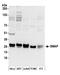 Chromosome 11 Open Reading Frame 58 antibody, A304-688A, Bethyl Labs, Western Blot image 