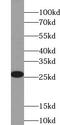 Translin antibody, FNab09048, FineTest, Western Blot image 