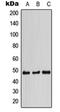 Signal Transducing Adaptor Family Member 2 antibody, orb215216, Biorbyt, Western Blot image 