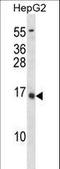 BGP antibody, LS-C156804, Lifespan Biosciences, Western Blot image 
