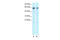 5-hydroxytryptamine receptor 2C antibody, 31-115, ProSci, Enzyme Linked Immunosorbent Assay image 