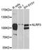 NLR Family Pyrin Domain Containing 3 antibody, A6345, ABclonal Technology, Western Blot image 