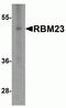 RNA Binding Motif Protein 23 antibody, NBP2-81986, Novus Biologicals, Western Blot image 