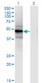 Solute Carrier Family 25 Member 25 antibody, H00114789-M02, Novus Biologicals, Western Blot image 