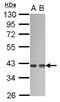 G Protein Subunit Alpha 12 antibody, NBP2-16556, Novus Biologicals, Western Blot image 