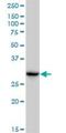 Carbonyl Reductase 3 antibody, H00000874-M05, Novus Biologicals, Western Blot image 