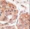 SMYD Family Member 5 antibody, LS-C100481, Lifespan Biosciences, Immunohistochemistry paraffin image 