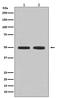Hyaluronan And Proteoglycan Link Protein 1 antibody, M05980, Boster Biological Technology, Western Blot image 