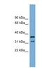 Potassium Channel Tetramerization Domain Containing 21 antibody, NBP1-79549, Novus Biologicals, Western Blot image 