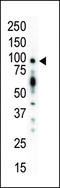 Serine/threonine-protein kinase D1 antibody, LS-C98928, Lifespan Biosciences, Western Blot image 