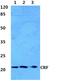 Corticotropin Releasing Hormone antibody, GTX66703, GeneTex, Western Blot image 