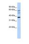 UDP Glucuronosyltransferase Family 1 Member A9 antibody, NBP1-69689, Novus Biologicals, Western Blot image 