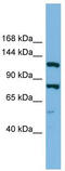 Hypoxia Up-Regulated 1 antibody, TA339043, Origene, Western Blot image 