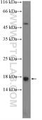 Lymphocyte Antigen 6 Family Member H antibody, 23933-1-AP, Proteintech Group, Western Blot image 