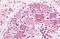 5-Hydroxytryptamine Receptor 1D antibody, GTX78103, GeneTex, Immunohistochemistry paraffin image 