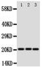 Surfactant Protein C antibody, PA1933, Boster Biological Technology, Western Blot image 