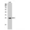 B Cell Receptor Associated Protein 31 antibody, LS-C382244, Lifespan Biosciences, Western Blot image 