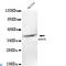 Alpha-Methylacyl-CoA Racemase antibody, LS-C814090, Lifespan Biosciences, Western Blot image 