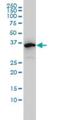 Eukaryotic Translation Initiation Factor 2B Subunit Beta antibody, H00008892-M01, Novus Biologicals, Western Blot image 