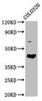 G Protein Subunit Alpha L antibody, LS-C680536, Lifespan Biosciences, Western Blot image 