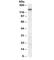 ATP Binding Cassette Subfamily C Member 5 antibody, R34373-100UG, NSJ Bioreagents, Western Blot image 