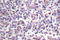 B-Raf Proto-Oncogene, Serine/Threonine Kinase antibody, LS-C176390, Lifespan Biosciences, Immunohistochemistry frozen image 