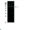 Poly(ADP-Ribose) Polymerase 1 antibody, LS-C813281, Lifespan Biosciences, Western Blot image 