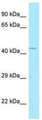 Polymerase delta-interacting protein 2 antibody, TA338062, Origene, Western Blot image 